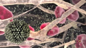 Learn About the Causes of Atherosclerosis