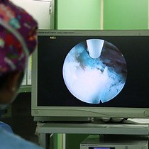 Video: A Mobile Outside-in Technique of Transforaminal Lumbar Endoscopy for Lumbar Disc Herniations