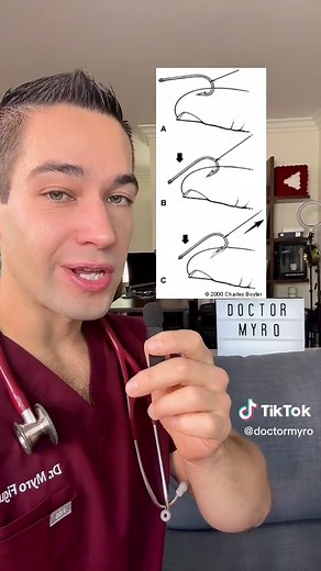 How to Safely Remove a Fish Hook: Tips and Tricks