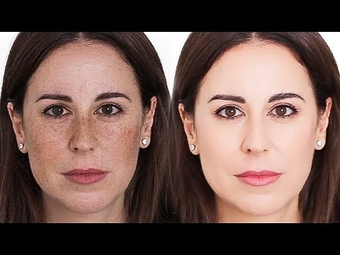 MANCHAS: ¿Cómo eliminar las manchas faciales? | Miriam Llantada