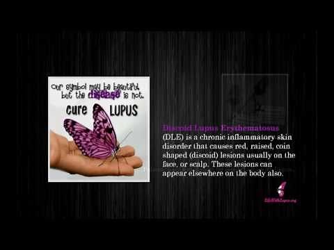 Discoid Lupus Pictures
