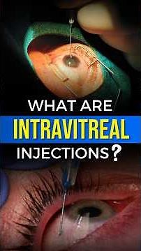 What Are Intravitreal Eye Injections? || Retina Injections