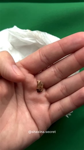 Shaxina Forsiy | Yaqinlaringizga junatib qo’ying bu narsa buruning ichiga epishib ter o’sib boshlashi mumkin va miyaga kislorod etishmovchiligi... | Instagram