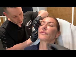 Sculptra | Collagen-Stimulating Injections | West Hollywood, CA | Dr. Jason Emer