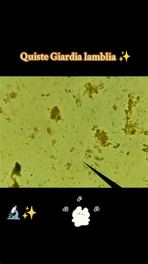 Quiste de Giardia lamblia ✨🔬 #giardia #lab #parasitos #labclinico🦠🔬 #🤓🤓 #🔬 #paratiiiiiiiiiiiiiiiiiiiiiiiiiiiiiii #videoviral #😉