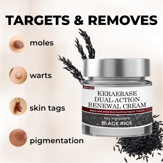 Biancat® KeraErase uses Thuja, Tea Tree, Rice Bran, and Niacinamide to soften bumps, dissolve keratin, and brighten dark spots—all without acids or irritation. Smooth skin starts in 7–14 days. https://opulentderm.com/products/keraerase-dual-action-renewal-cream | Kayleigh Elwell Eric