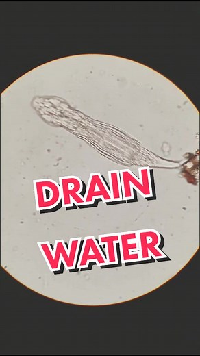 Exploring Nematode Worms: Differences and Similarities