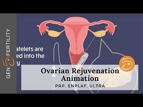 Ovarian Rejuvenation Animation | Gen 5 Fertility Center