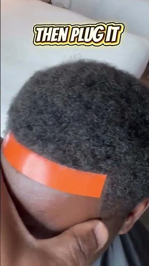 Learn how we rebuild front hairlines for a natural, seamless look.