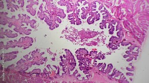 Cervix in section filmed under light micrograph with 40 times magnification on bright field. Research of human female tissue samples. analyzing pathology of cervical cancer in lab in gynecology fields