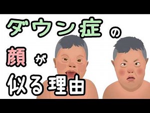 ダウン症の顔つきが似る理由