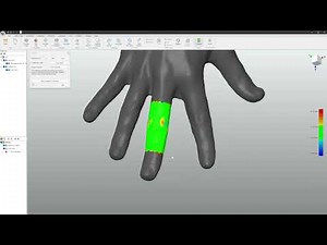Workflow: QUICKSURFACE for Medical Purposes