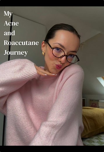 My Journey with Acne and Roaccutane Treatment
