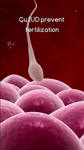 How Does Copper IUD Works? 🤔 #shorts