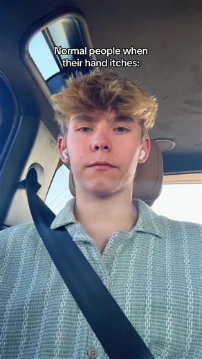 Handling Itchy Hands: A Relatable Experience