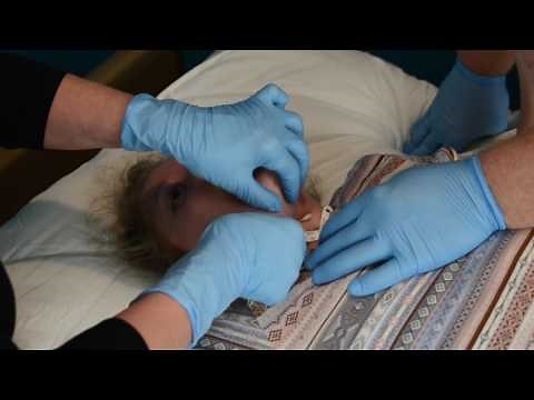How To: Trach Stoma Care