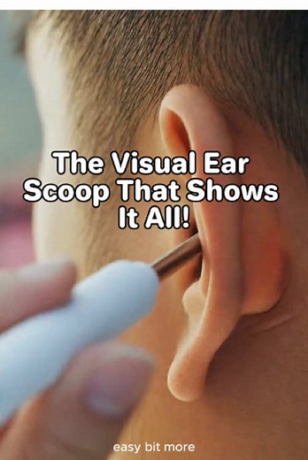 Clean ears = flawless beauty. ✨ Use the visual ear picker to make sure your ears are as fresh as your face. Clean ears are part of the glow-up! 💖 #BeautyInfluencer #EarCareRoutine #FlawlessBeauty #CleanEars #BeautyHacks