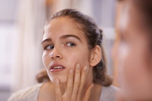 Skin Purging: How to Tell If a Skincare Product Is Making You Breakout