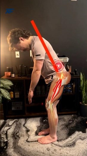 Sciatica Recovery in 22 Days (Real Patient Results)