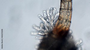 ciliates attached to a cyclops, colony of ciliates