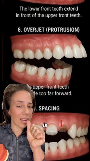Protruding Front Teeth? Here's What's Actually Happening