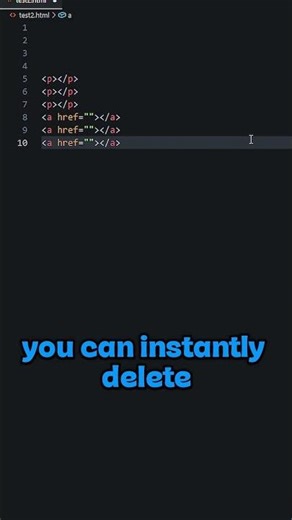 Why are you struggling just to delete a line? #shorts #shortsvideo #vscode
