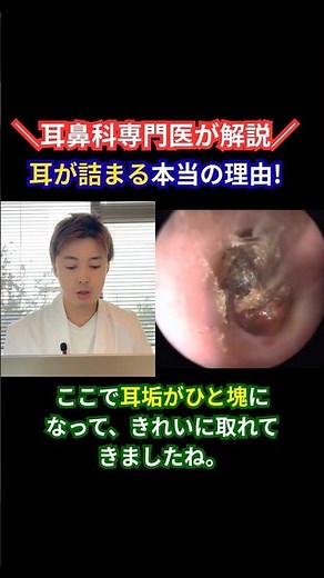 [Explained by an ENT specialist] The moment earwax comes out in one big clump! What causes ear bl...