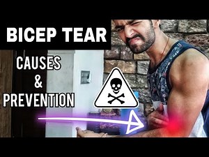 Bicep Tendon Tear - Causes & Prevention [HINDI]