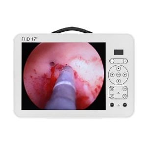 [Hot Item] Medical Portable CCD Endoscope Camera System Ent Endoscope Video Imaging Equipment for Hospital Use