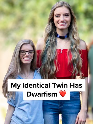 Identical Twins: One With Primordial Dwarfism