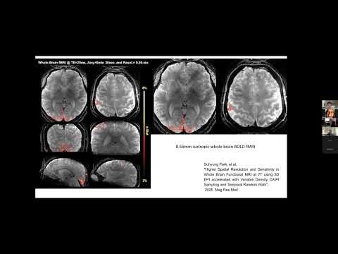 Tuning your scanner for fMRI, a virtual ISMRM Brain function study group meeting