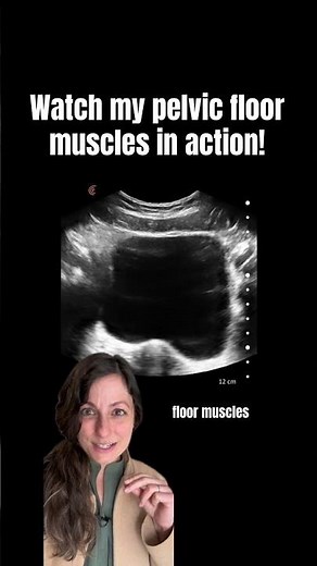 Watch pelvic floor muscles in live action with real-time ultrasound biofeedback! #learn #pelvicfloor