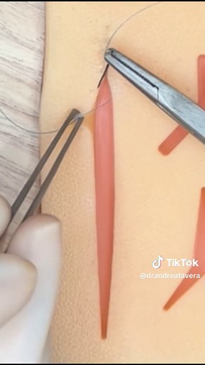 Subcuticular running suture #suturepractice #suture #CirugiaPlastica #plasticsurgery #suturetechnique #subcuticularsuture