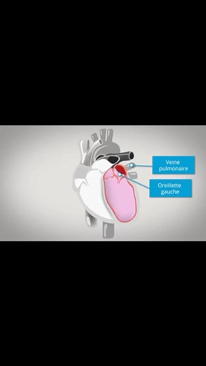 25K views · 582 reactions | #anatomie #cœur | Anatomie à tout prix | Facebook