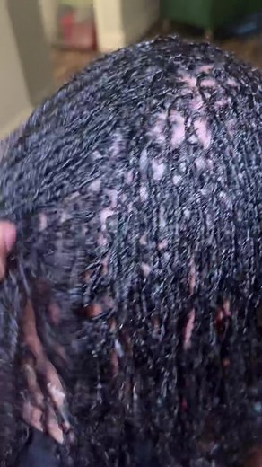 Micro Loc Installation: Interlock Method Guide