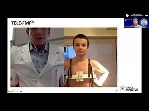 TELE FMF / PECTUS CARINATUM / FMF DYNAMIC COMPRESSOR SYSTEM
