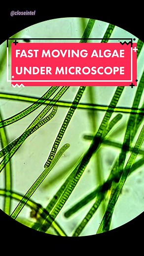 Exploring Cyanobacteria: A Microscopic World Wonder