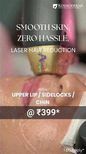 Laser Hair Reduction Upper Lips + Sidelocks +Chin @ 399