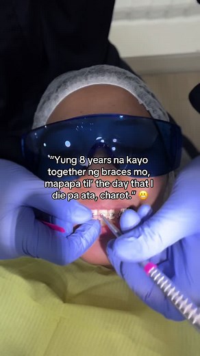 Braces: Forever Together in Orthodontics