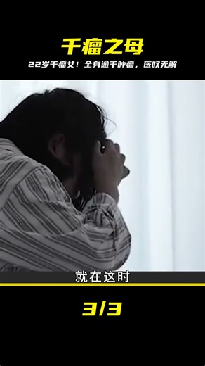 22歲女孩稱為“腫瘤之母”，全身超過1000個腫瘤，醫生有錢治不了 #鉴证史者 #古董 #開棺 #古墓 #考古發現