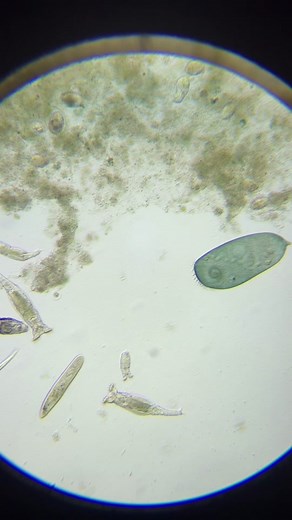 Stentor vs. Rotifers: Single-celled vs. Multicellular