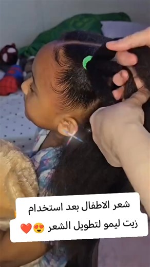 59K views · 362 reactions | #00249907666556 #510957728 #تطويل #تطويل_الشعر #تطويل_تغزير_تكثيف #تطويل_الشعر_ونعومة_مثل_الحرير #السعودية #السودان #مصر | ليمو لخلطات التفتيح | Facebook