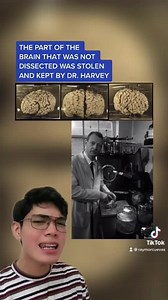 2.6M views · 10K reactions | Where is Albert Einstein's Brain? 易 --- Like and follow for more! | Raymor Cuevas | Facebook