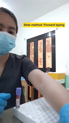 1.5K views · 72 reactions | Sharing:Episode 3 | Part 1 Blood typing also known as ABO-Rh typing 2 methods: 1. Slide Method - slide ang gamit (gaya ng nasa video) 2. Tube Method- Test tube ang gamit Blood typing can be done in 2 ways: 1. FORWARD TYPING (ito po ang aking ginamit sa video) Reagent: ANTI-SERA Sample: Patient's blood/Red Cell 2. REVERSE TYPING Reagent: Known A and Known B Sample: Patient's plasma Disclaimer: Ang mga ito po ay base sa aming napag-aralan at sa mga ginagawa namin sa lab