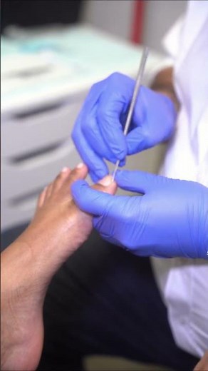 Chiropody at PinPoint Health