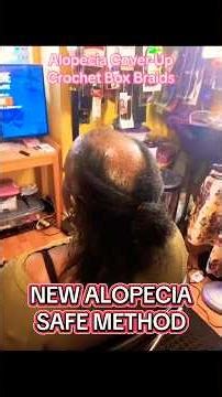 Alopecia-Friendly Crochet Tips You Need to Know #viralvideo #alopecia #newvideo