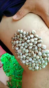 Giant tick. ... - 7288865176839802155_fix_000 #trending #bohkbla #giantticks #fyp #foryou #trypophobia | Daisy Video