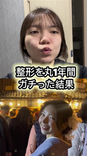 整形を通じて普通の女の子になりたい！