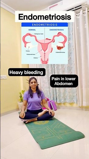 Endometriosis? Try these yoga poses to get relief 😊 #endometriosis #painrelief #yoga