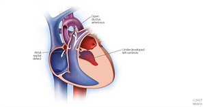 107K views · 287 reactions | Want to learn more about the special needs for adults living with congenital heart disease? Dr. Francois Marcotte, a cardiologist specializing in ACHD discusses in this #MayoClinicHeartChat. | Mayo Clinic | Facebook